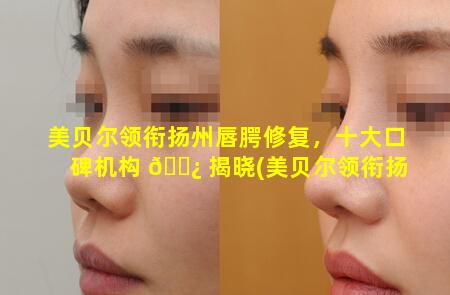 美贝尔领衔扬州唇腭修复，十大口碑机构 🌿 揭晓(美贝尔领衔扬州唇腭修复,十大口碑机构揭晓)